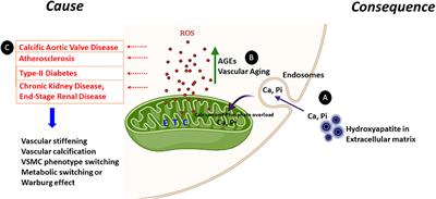 Mitochondrial Dysfunction: Cause or Consequence of Vascular Calcification?